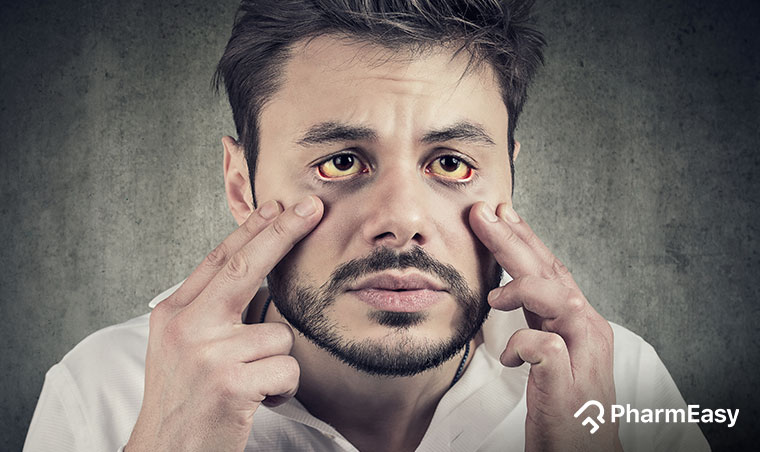 jaundice symptoms and treatment