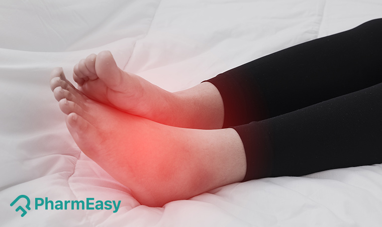 home remedies for swelling in legs