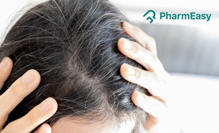 what causes white hair at early age