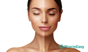 Home Remedies For Tanned Skin