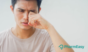 itchy eyes home remedy