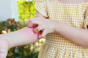 itchy skin in children